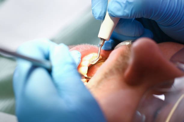 Best Dentist for Severe Toothache  in Sandoval, IL