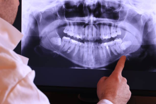 Best Root Canal Emergency Dentist  in Sandoval, IL
