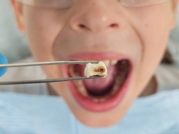 Best Dentist Open Late Near Me  in Sandoval, IL